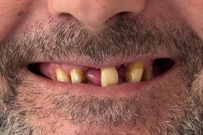 caso-clinico-10-antes