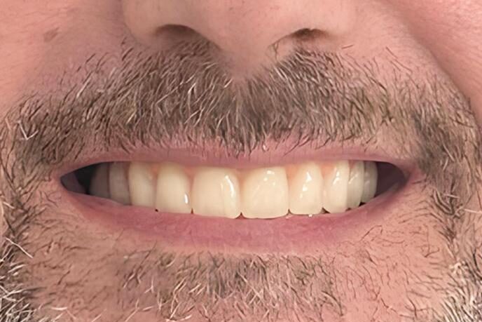 caso-clinico-10-depois