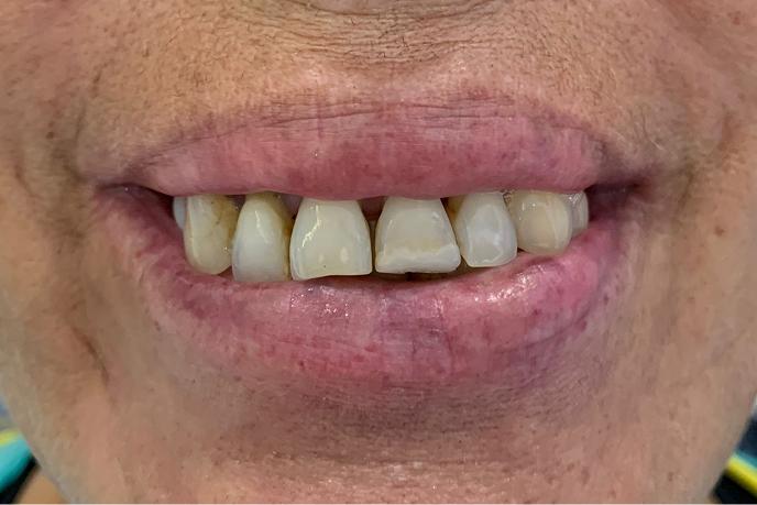 caso-clinico-2-antes