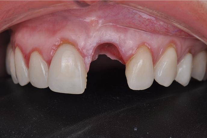 caso-clinico-3-antes