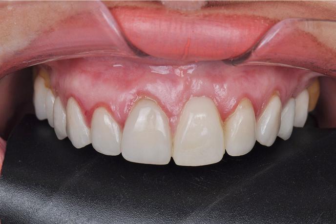 caso-clinico-3-depois