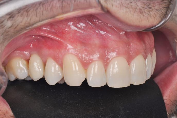 caso-clinico-4-depois