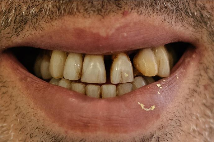 caso-clinico-5-antes