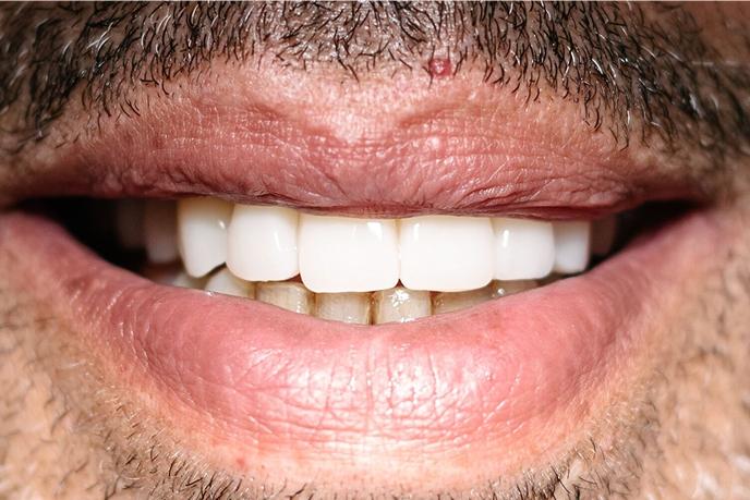 caso-clinico-5-depois