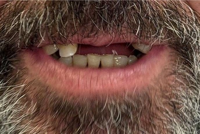 caso-clinico-7-antes