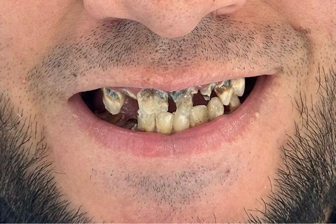 caso-clinico-8-antes