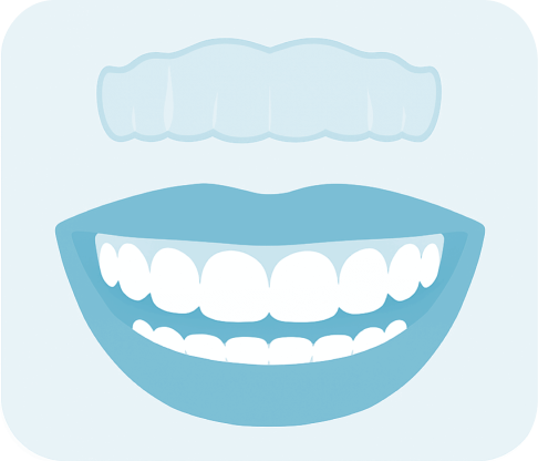 Alinhadores Invisíveis