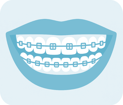 Aparelho Fixo Metálico